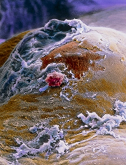 False-colour SEM of the ovary surface at ovulation False-colour SEM of the ovary surface at ovulation