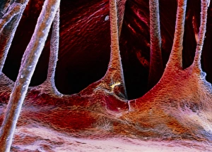 False-colour SEM of a portion of a cardiac valve False-colour SEM of a portion of a cardiac valve