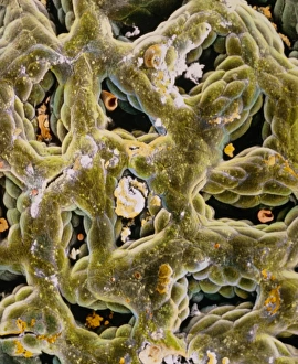 False-colour SEM of secreting gastric glands False-colour SEM of secreting gastric glands