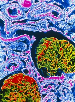 False-colour SEM showing two renal glomeruli False-colour SEM showing two renal glomeruli
