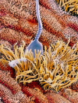 False-colour SEM of sperm in uterus False-colour SEM of sperm in uterus