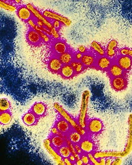 False-colour TEM of hepatitis B virus particles False-colour TEM of hepatitis B virus particles