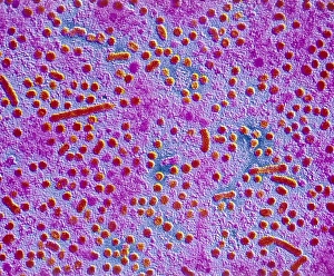 False-colour TEM of hepatitis B viruses False-colour TEM of hepatitis B viruses
