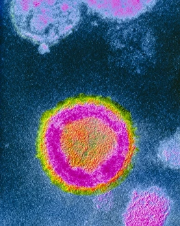 False-colour TEM of HIV-2 virus causing AIDS False-colour TEM of HIV-2 virus causing AIDS