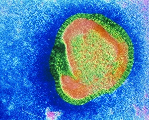 False colour TEM of an influenza virion False colour TEM of an influenza virion