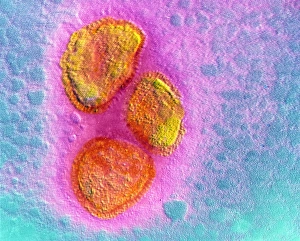 False-colour TEM of mumps virus particles False-colour TEM of mumps virus particles