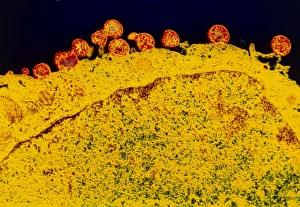 False-colour TEM of Mycoplasma sp False-colour TEM of Mycoplasma sp