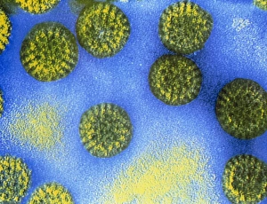 False-colour TEM of rotavirus particles False-colour TEM of rotavirus particles