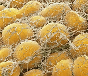 Images Dated 9th February 2012: SEM Print of Adipocytes in Connective Tissue