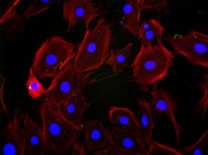 Fibroblast cells Print, Immunofluorescence Micrograph