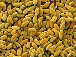 Coloured Scanning Electron Micrograph Prints: Flame lily pollen, SEM