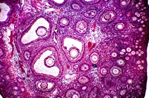 Female Reproductive System Anatomy Prints: Follicles in a human ovary, micrograph