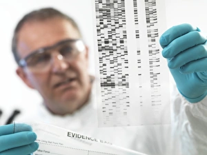 Forensic Science Print: DNA Autoradiogram Examination
