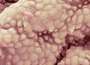 SEM Prints: Gallbladder Surface Print, SEM