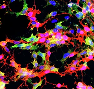 Glial stem cell culture, light micrograph Glial stem cell culture, light micrograph