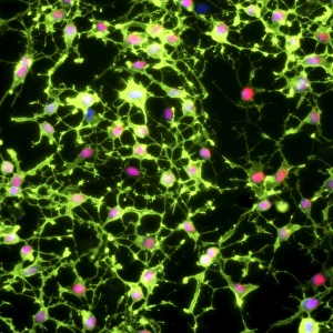 Glial stem cell culture, light micrograph Glial stem cell culture, light micrograph