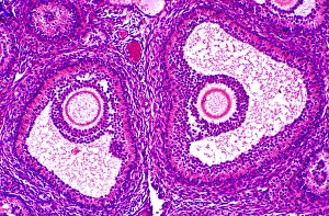 Female Reproductive System Prints: Graafian follicles, light micrograph