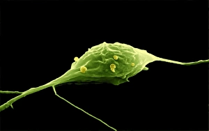 SEM Print of a Granule Nerve Cell
