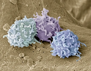 White Blood Cells SEM Prints: Granulocytes, SEM