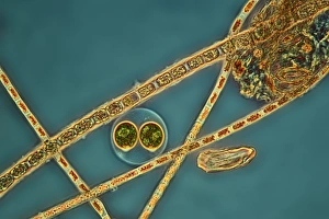 Light Microscopy Images Prints: Green algae, light micrograph C016 / 8595