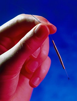 Hand holds a GyneFIX intrauterine contraceptive Hand holds a GyneFIX intrauterine contraceptive