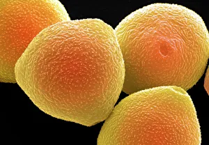 Hazel pollen grains Hazel pollen grains