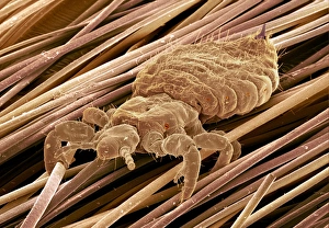 Images Dated 2000 July: Head Louse Print, Coloured SEM of a Blood-Sucking Insect