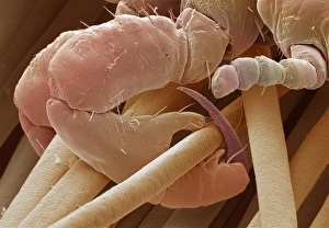 Head louse claw Head louse claw