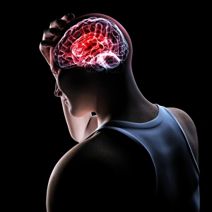 Headache Print, a conceptual artwork