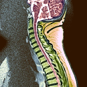 Healthy spine Healthy spine