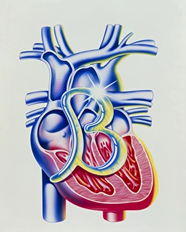 Heart disease: art of heart & beta blocker symbol Heart disease: art of heart & beta blocker symbol