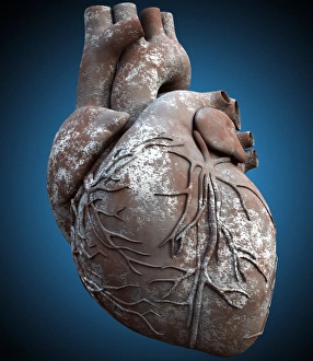 Heart of stone Heart of stone