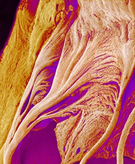 Tricuspid Valve and Chordae Tendineae Print