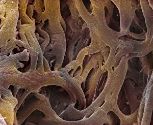 Heart valve tendons, SEM Heart valve tendons, SEM