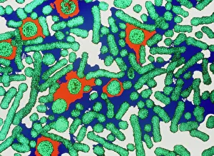 Hepatitis B virus print