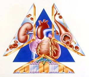 High blood pressure, artwork High blood pressure, artwork