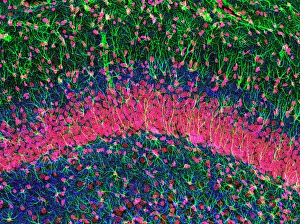 Hippocampus Brain Tissue Print