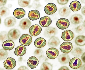 Prints of HIV (human immunodeficiency virus) particles, coloured transmission electron micrograph (TEM) Images Dated 2009 June: TEM HIV particles Print, coloured transmission electron micrograph