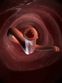 Intestinal Parasites Prints: Hookworm, artwork