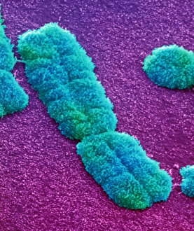 Human chromosome Human chromosome