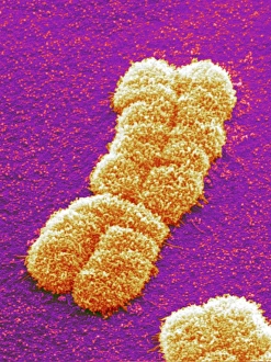 Prints of Human chromosome. Coloured scanning electron micrograph (SEM) of a human chromosome as a pair of identical copies called chromatids. These form as part of chromosome replication during cell division Images Dated 2004 June: SEM Human Chromosome Pair Print