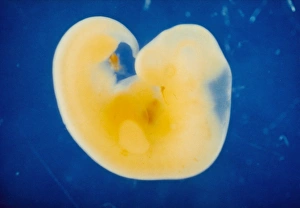 The human embryo at four weeks of gestation The human embryo at four weeks of gestation
