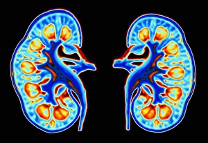 Human kidneys Human kidneys