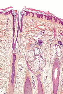 Human skin section, light micrograph Human skin section, light micrograph