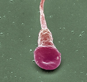 Human sperm cell, SEM Human sperm cell, SEM
