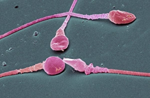 Human sperm cells, SEM Human sperm cells, SEM