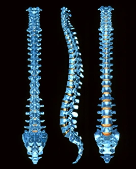 Human spine, three views Human spine, three views