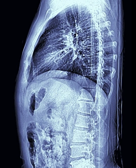 Normal Human Torso MRI Scan Print
