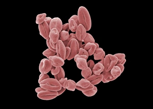 SEM Images Of Pollen Prints: Hypericum pollen