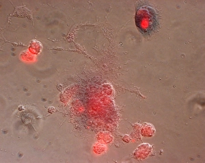 White Blood Cell Function Prints: Immune response